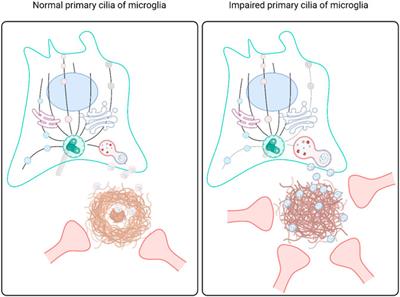 Primary cilia-mediated regulation of microglial secretion in Alzheimer’s disease